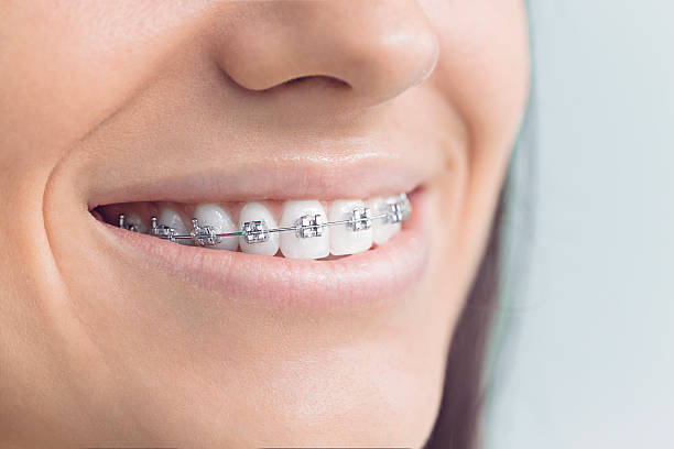 Best Veneers and Lumineers  in Wickes, AR